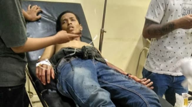 3 Pemuda Bekasi Dibacok Geng Motor Sampai Tangan Putus dan Robek